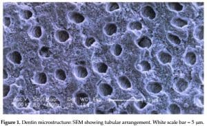 dentin conductivity due to tubular system