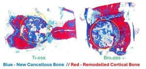 more bone than bio-oss