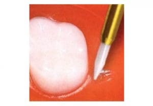 regen_0064_Zirconia Trimmer