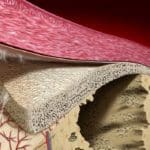 dental membranes for GBR