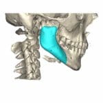 jaw2-square