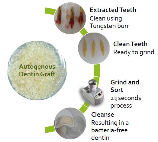 Tooth Grinder; Dentin Grinder