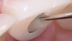 SilverPlug (20)