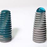 Powerbone Plasma Treated Dental Implant